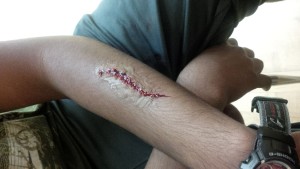 Accident Simulation for Red Cross, WorkSafeBC or equivalent trained individuals