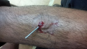 Accident Simulation for Red Cross, WorkSafeBC or equivalent trained individuals